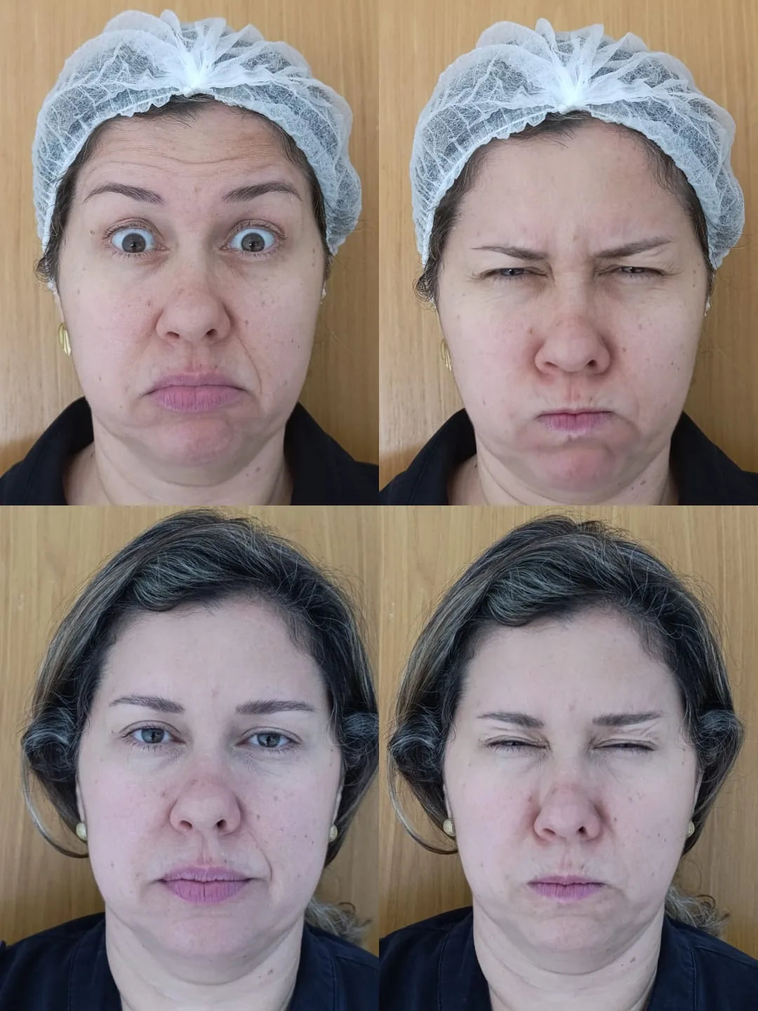 Toxina botulínica, testa