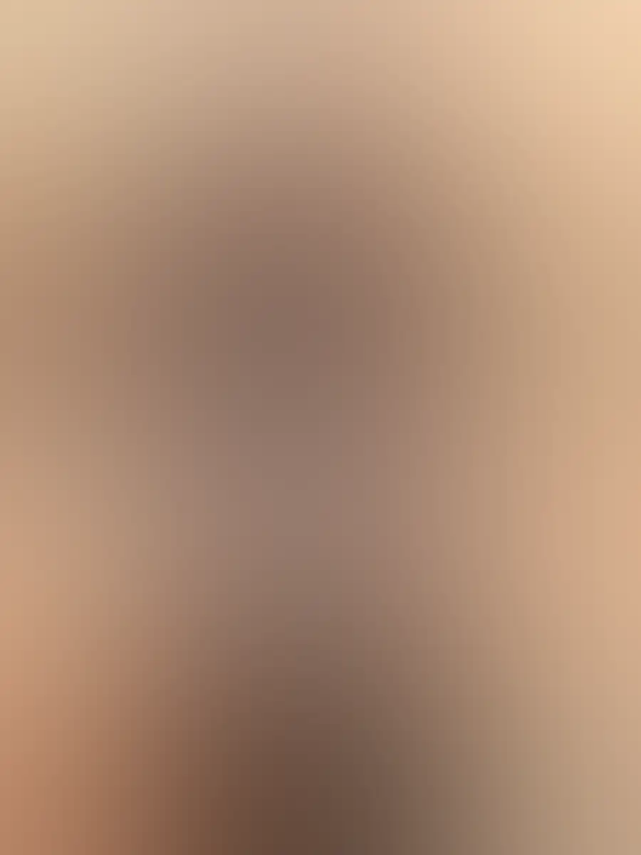 Harmonização íntima, imagem desfocada por privacidade